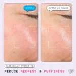 The Depuffer by Dr. Shereene Idriss