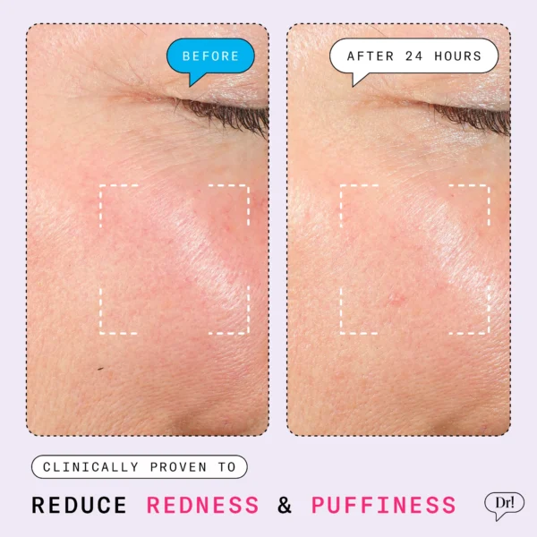 The Depuffer by Dr. Shereene Idriss